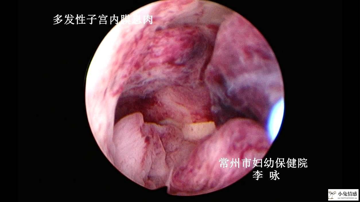 中年夫妻应该多学性爱技巧(图)