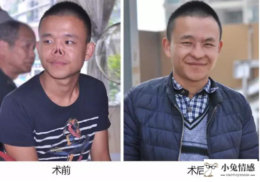 男人性无能心里_能控性,能观性_什么药可以让男人失去性工能