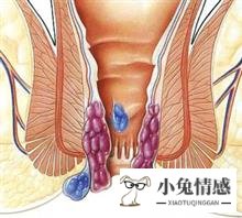 最好的方法:男人阳痿竟是心理因素作怪