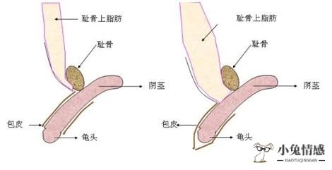 男人性无能心里_性心里变态测试题_无肌病性皮肌炎能痊愈